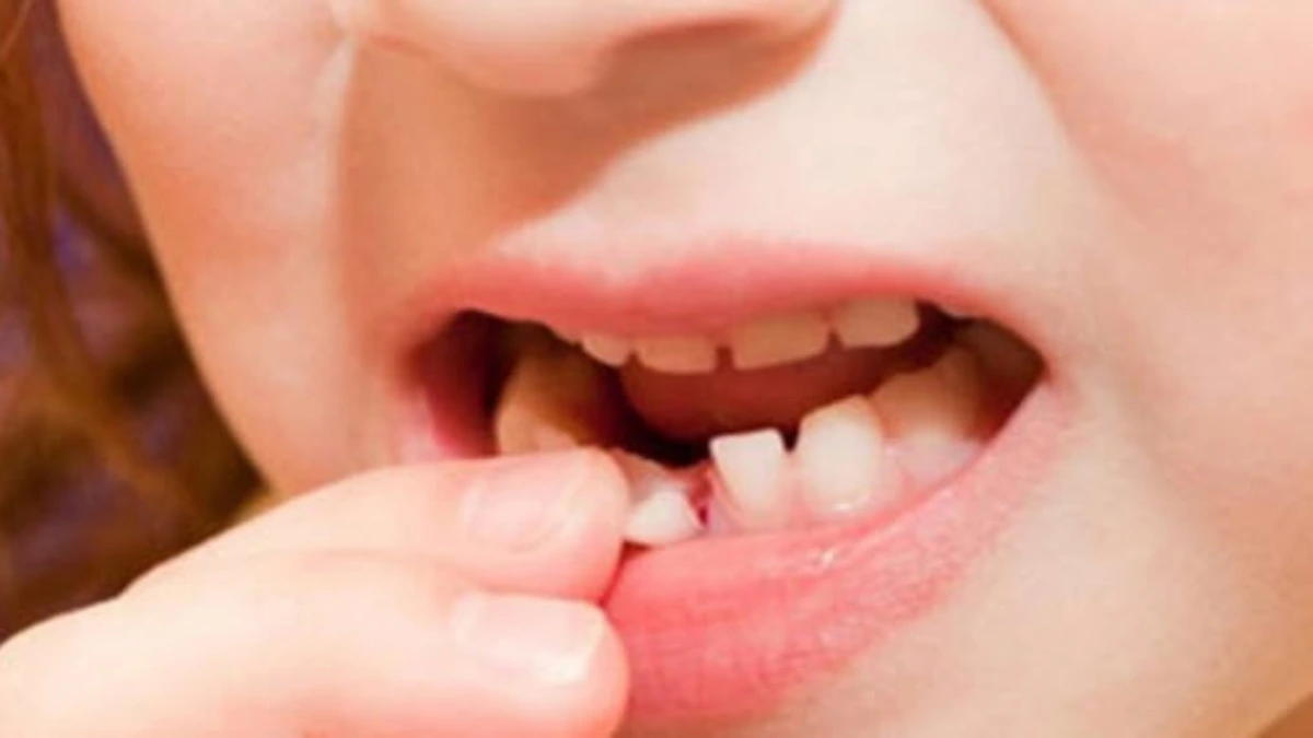 what does losing all your teeth in a dream mean