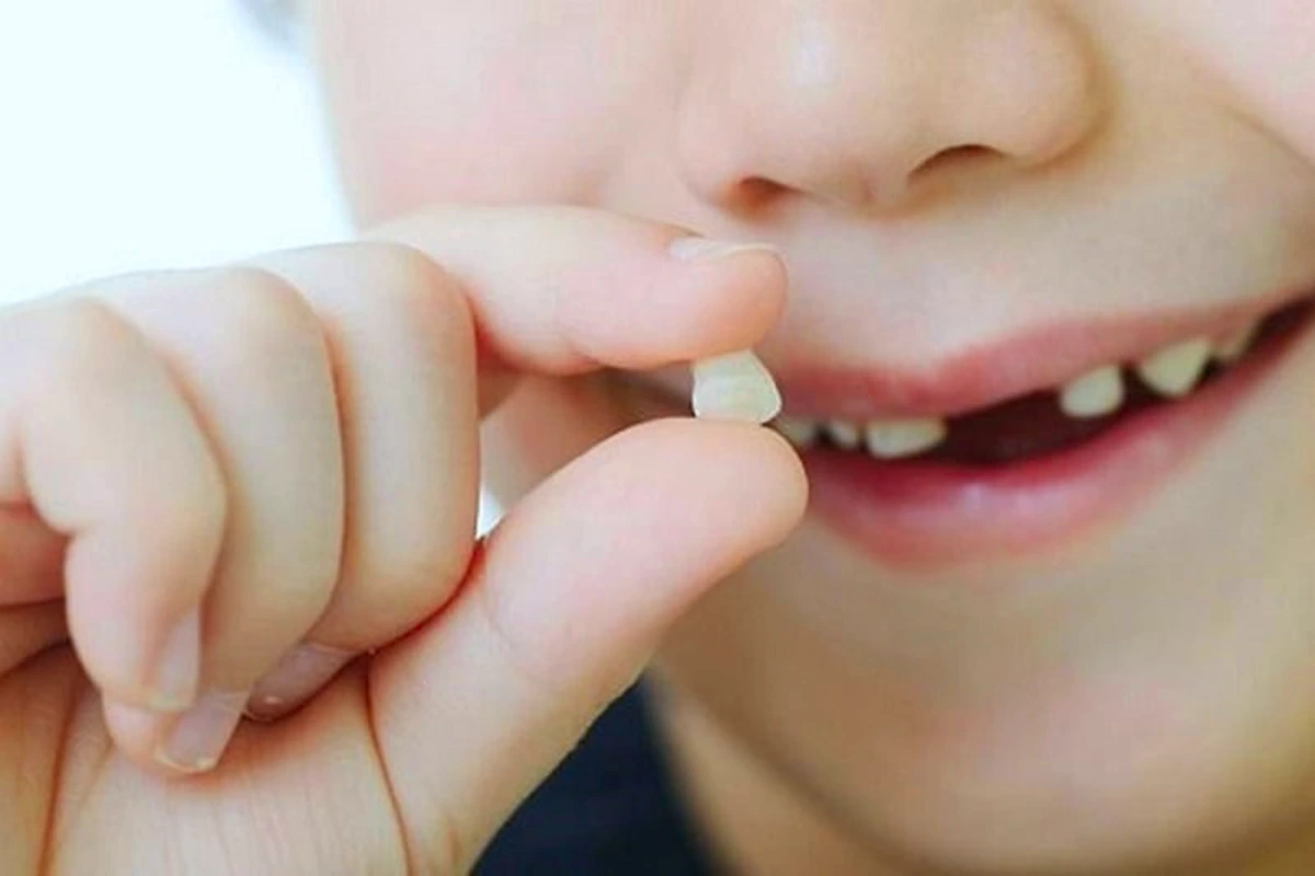 dream definition teeth falling out